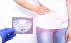 Lekarz w niebieskiej rękawiczce pokazuje tomografię komputerową jamy brzusznej, która może pomóc w diagnostyce zapalenia wyrostka robaczkowego. Pacjentka trzyma się za brzuch.