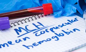 Na notatniku zapisano "MCH - mean corpuscular hemoglobin". Obok probówki z krwią, rękawiczki i stetoskop.