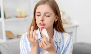 Młoda kobieta z krwawiącym nosem, być może objaw choroby von Willebranda, przykłada chusteczkę.