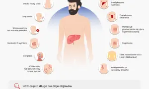 Objawy problemów z wątrobą: powiększona wątroba, zmęczenie, żółtaczka. Warto skonsultować się z lekarzem od wątroby.