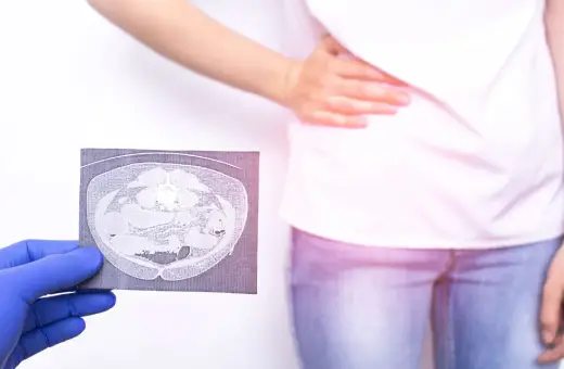 Lekarz w niebieskiej rękawiczce pokazuje tomografię komputerową jamy brzusznej, która może pomóc w diagnostyce zapalenia wyrostka robaczkowego. Pacjentka trzyma się za brzuch.