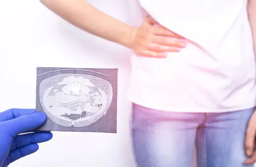 Lekarz w niebieskiej rękawiczce pokazuje tomografię komputerową jamy brzusznej, która może pomóc w diagnostyce zapalenia wyrostka robaczkowego. Pacjentka trzyma się za brzuch.