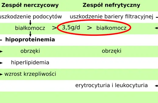 Schemat porównuje zespół nerczycowy i nefrytyczny, wskazując na białkomocz (>3,5g/d) jako kluczowy objaw.