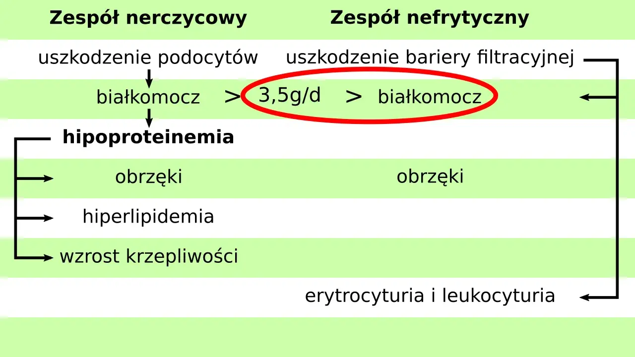 Schemat porównuje zespół nerczycowy i nefrytyczny, wskazując na białkomocz (>3,5g/d) jako kluczowy objaw.